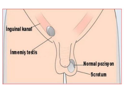 inmemis-testis inmemis-testis
